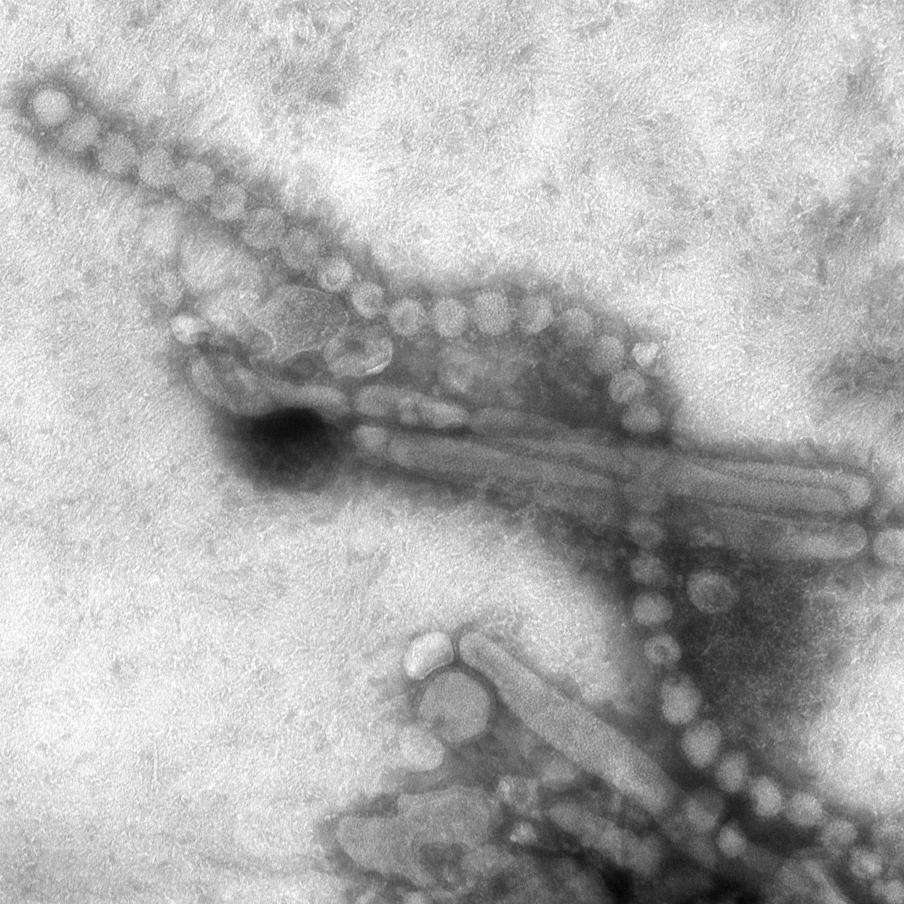 Вирусные частицы гриппа A H7N9 на электронной микрофотографии CDC